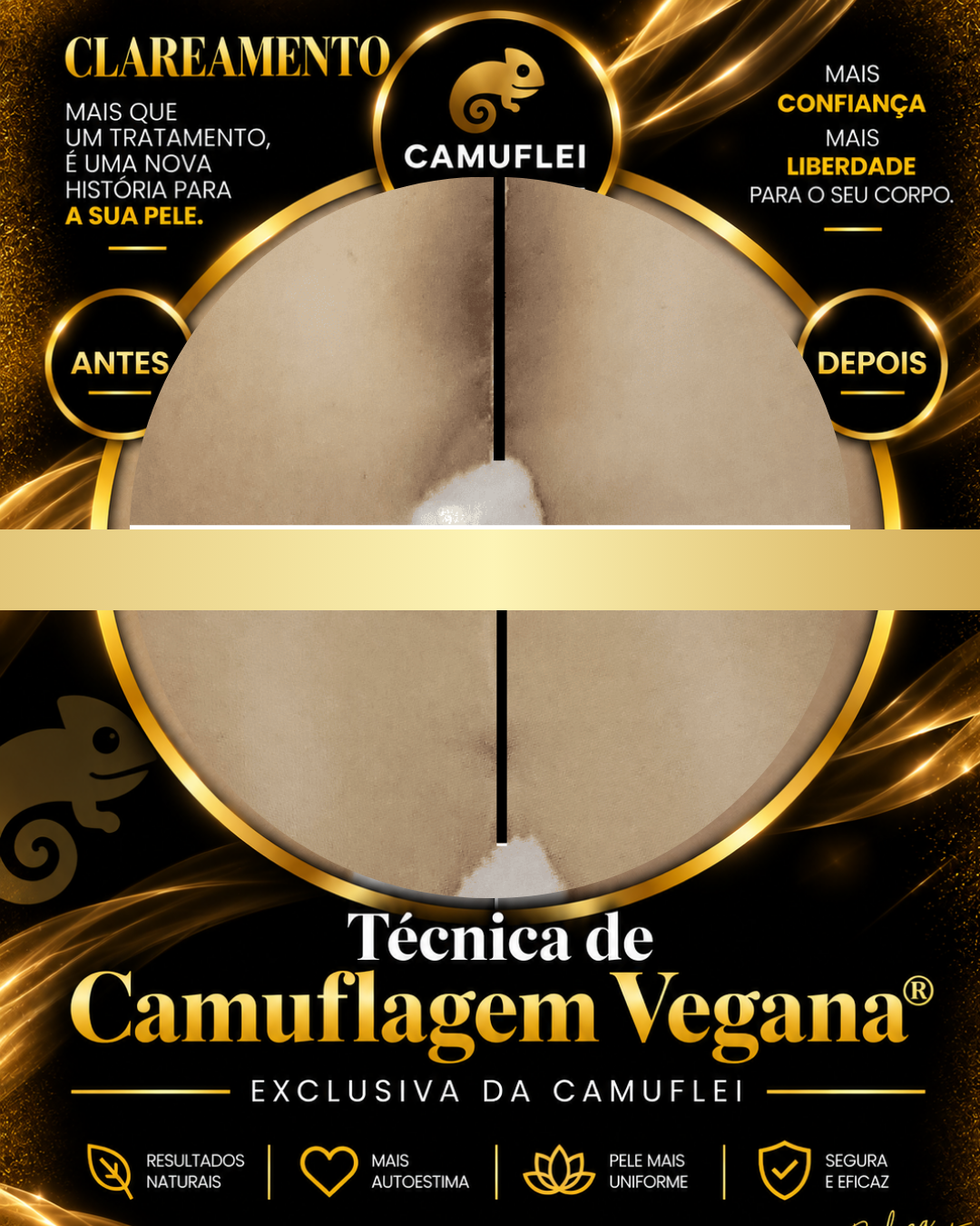 Resultado real de Camuflagem e clareamento, comparação antes e depois