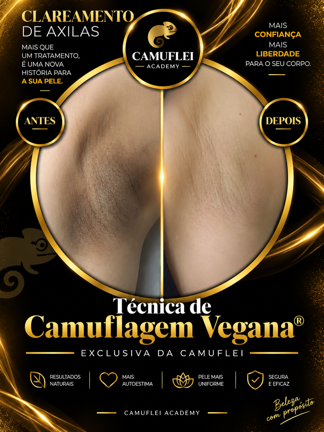 Resultado real de clareamento de axilas pela Camuflei